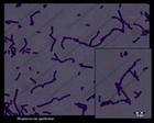 streptococcus GBS gram stain